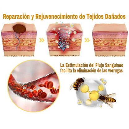 Aerosol contra el veneno de abeja